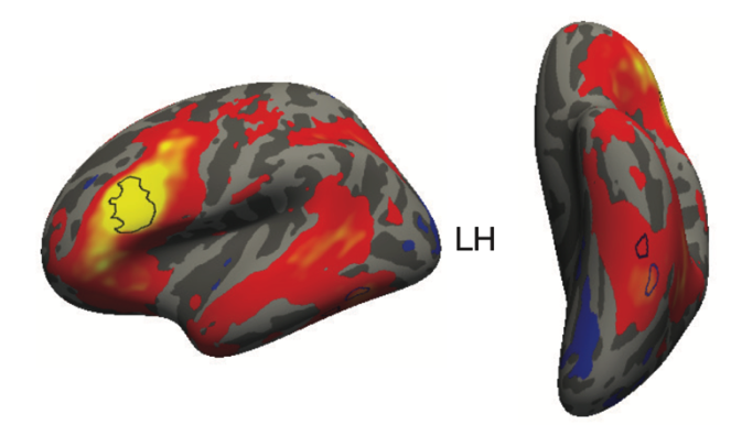 two views of the left cerebral hemisphere 